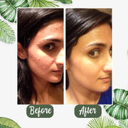 Last Day Promotion 49% OFF - 🔥Green Tea Deep Cleanse Mask