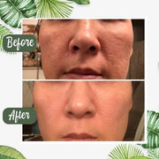 🍵Buy 1 Get 1 Free🍵 Deep Cleanse Green Tea Mask